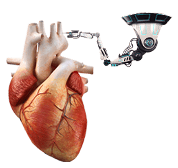 جراحات القلب بالروبوت