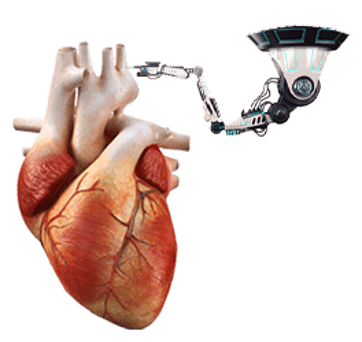 Robotic Heart Surgery