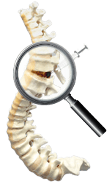 Spine Surgery