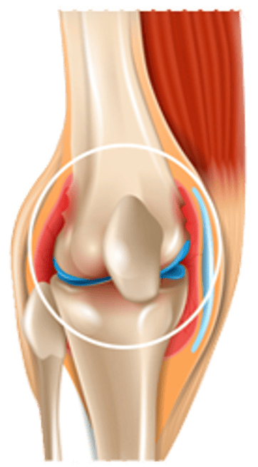 Hip and knee joint surgeries