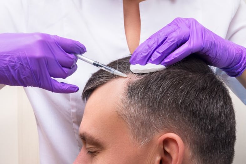Why does transplanted hair fall out ? | علاجك الطبية Why does transplanted hair fall out ? | علاجك الطبية