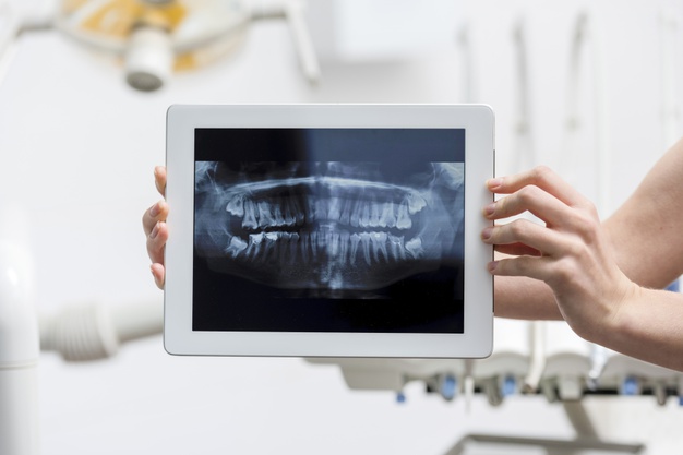 تكاليف دراسة طب الأسنان في تركيا وتخصصاته