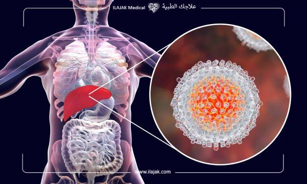  أعراض سوء التغذية