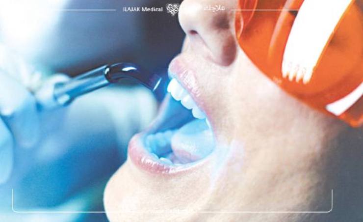 teeth whitening