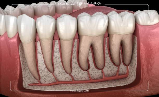 جذور الأسنان, علاج جذور الأسنان, معالجة قناة الجذر, قناة الجذر, أسعار علاج جذور الأسنان