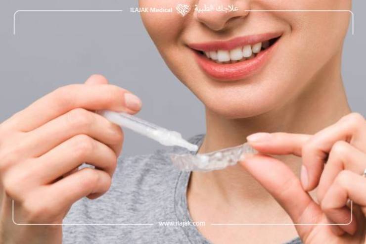 How to use whitening trays