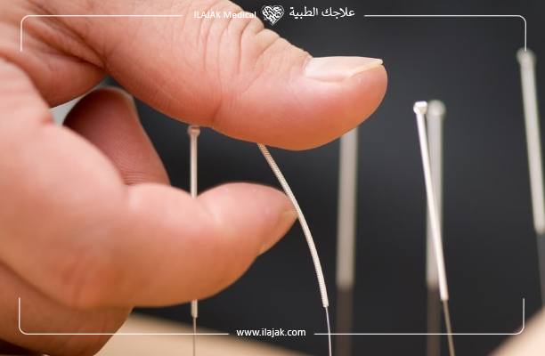 Comment fonctionne l’acupuncture ?