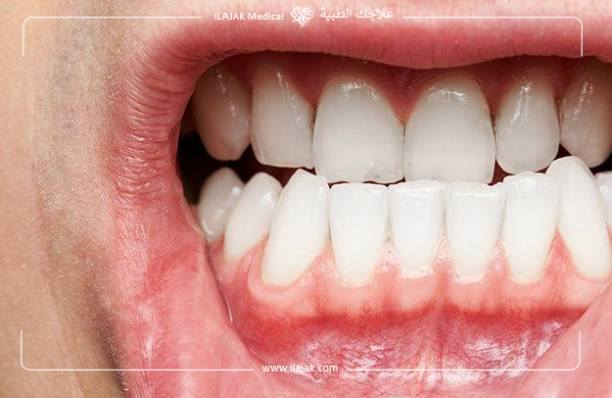 Traitement chirurgical