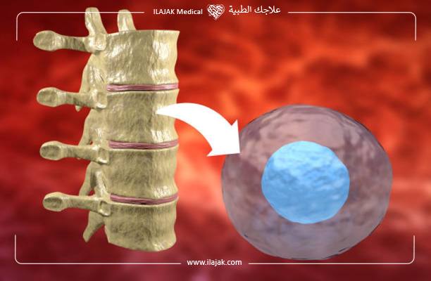 عملية زراعة نخاع العظم