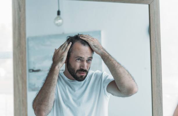 Carence en vitamine D et perte de cheveux : ?