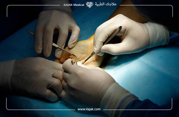 مميزات جراحة العظام في تركيا