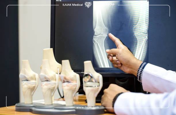 أفضل عيادات جراحة العظام في تركيا