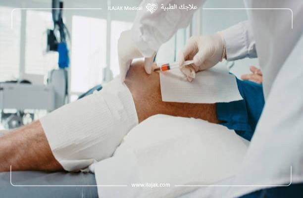 الآثار الجانبية لعلاج خشونة الركبة بالخلايا الجذعية