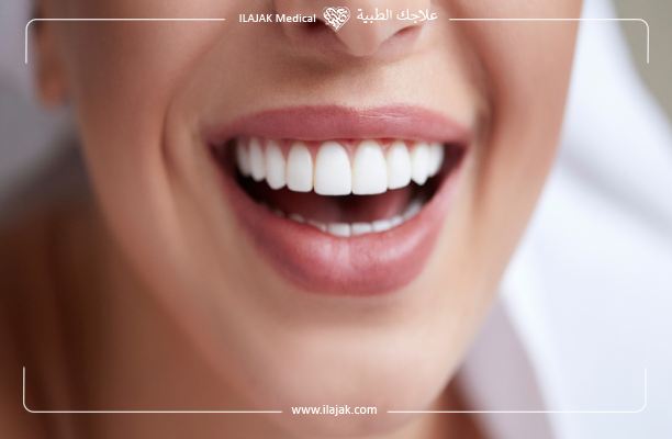How much is Hollywood smile price in Istanbul?