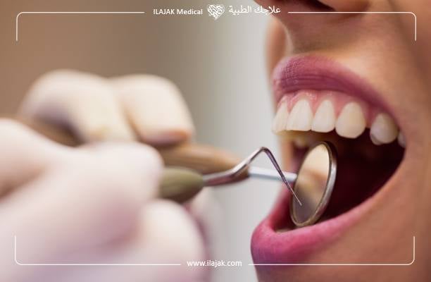 What are dental Veneers?
