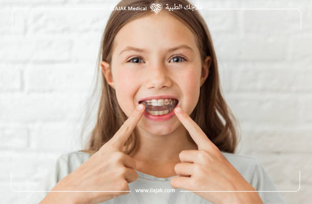 أهمية التركيب المبكر لتقويم الأسنان لدى الأطفال