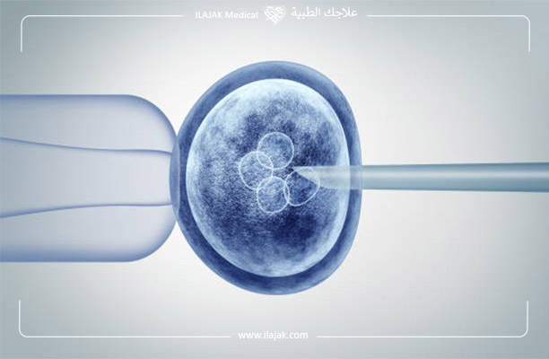 علاج العقم