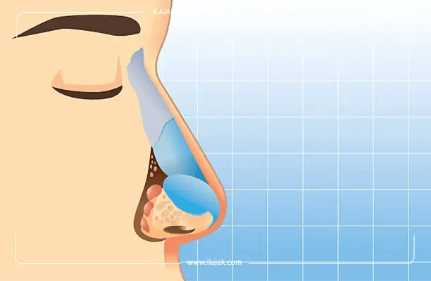  المناطق التي توجد فيها غضاريف في الجسم