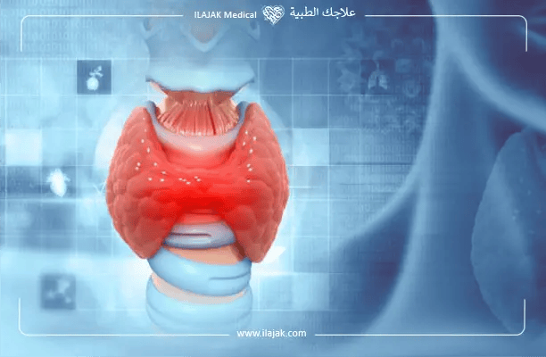 أعراض فرط نشاط الغدة الدرقية