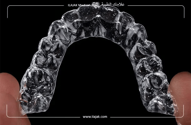 dental braces