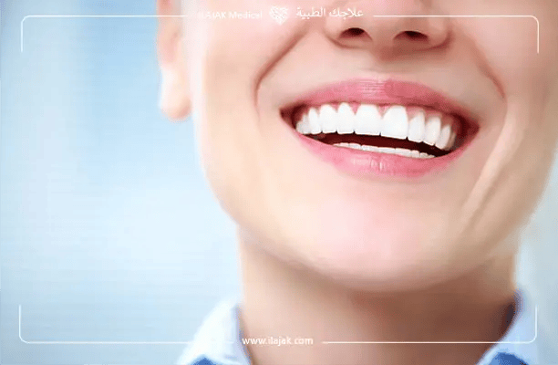 Straighten Teeth in Turkey