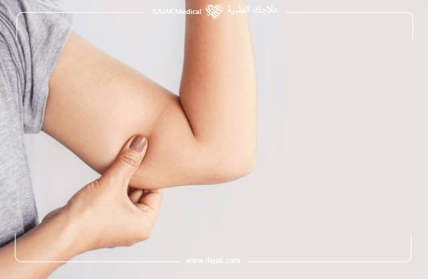 علاج السمنة وشفط الدهون من الذراعين