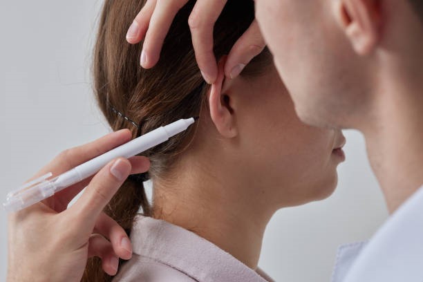 عملية تجميل الأذن في تركيا وتجميل الأذن الخفاشية