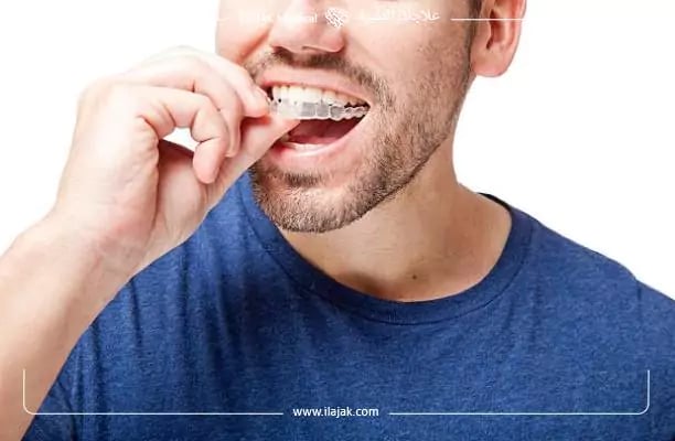 أسعار ابتسامة هوليود في تركيا - التقوم الخفى