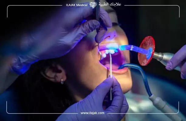 أسعار زراعة الأسنان في تركيا بالليزر 