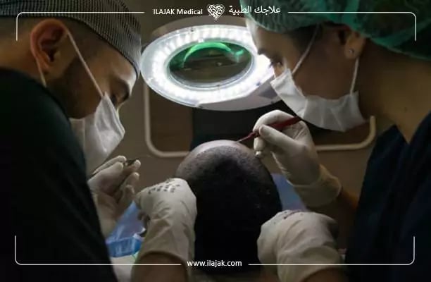 تكلفة زراعة الشعر في اسطنبول