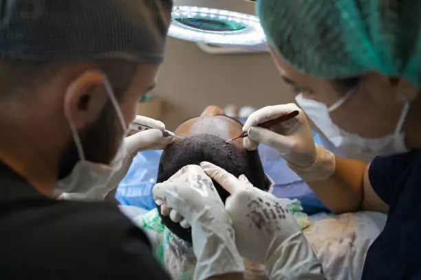زراعة الشعر بتقنية DHI من احدث تقنيات زراعة الشعر في تركيا