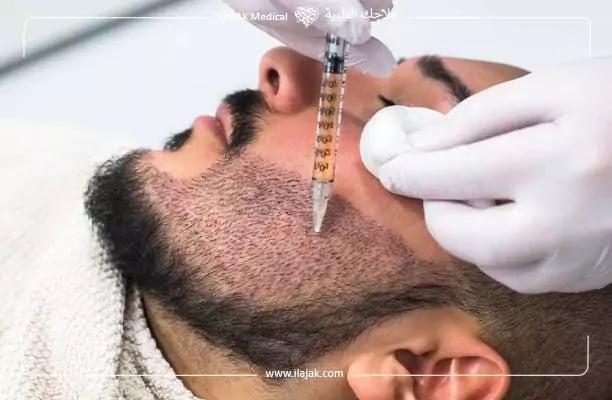 زراعة اللحية في تركيا