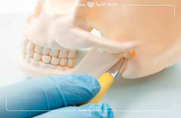دواعي اجراء جراحة الفك السفلي