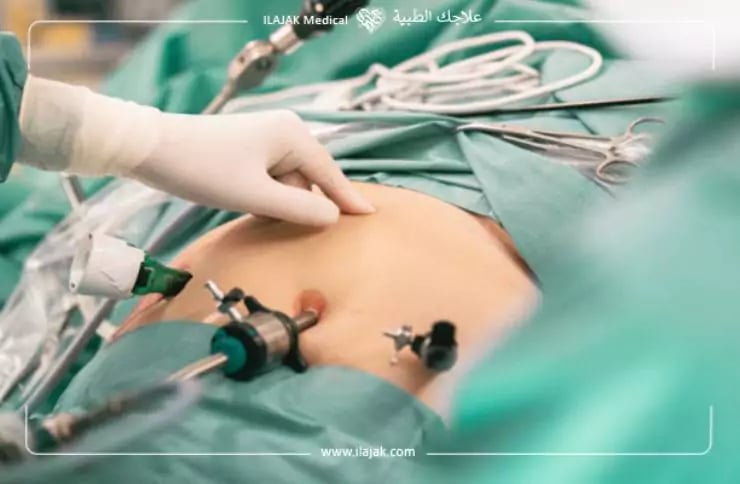 علاج السمنة