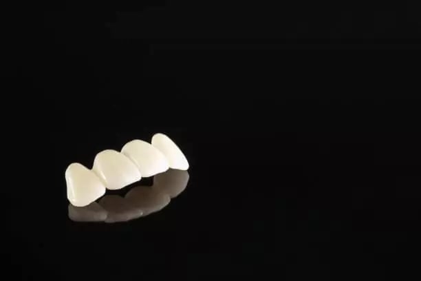 جسر الاسنان الزيركون