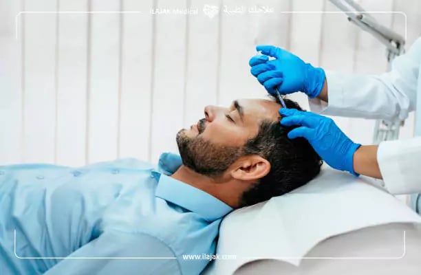هل يمكن تسريع نمو الشعر المزروع؟