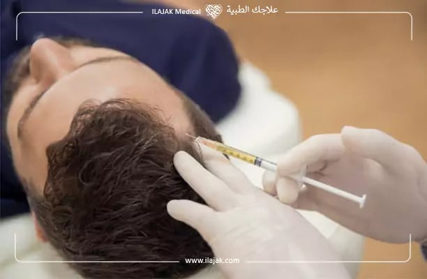 فوائد الميزوثيرابي لعلاج الشعر
