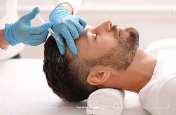مميزات الميزوثيرابي لتساقط الشعر