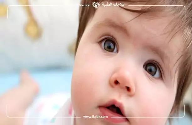 أنواع الحول عند الأطفال بالصور