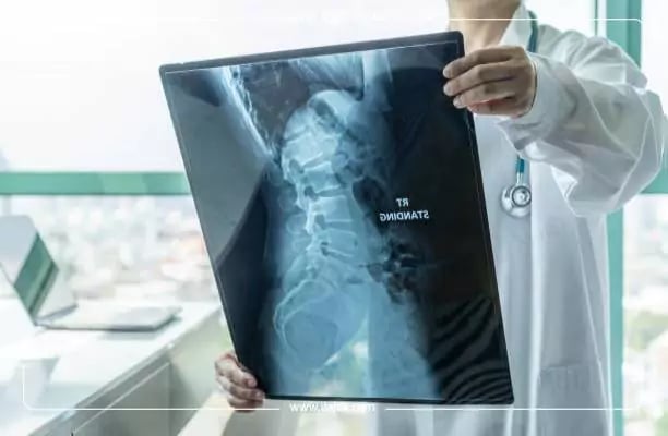 جراحة الاعصاب والعمود الفقري