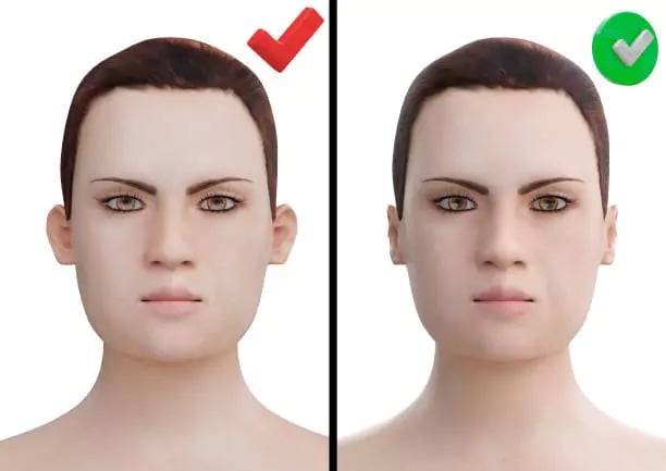 تجميل الأذن قبل وبعد