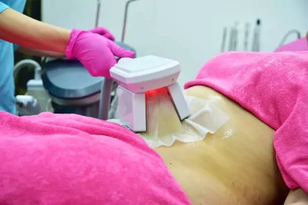 أسعار جلسات تجميد الدهون