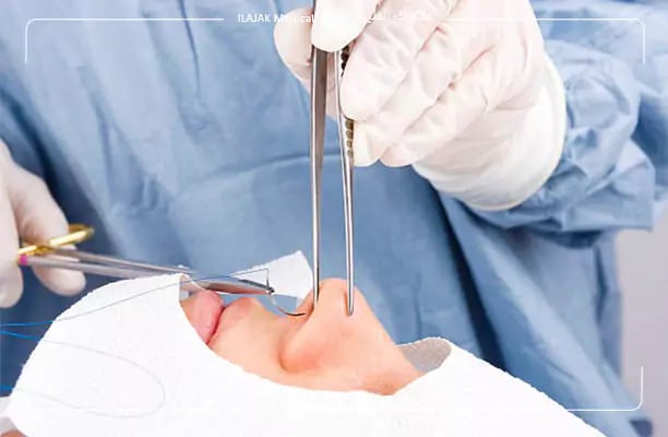 الفرق بين تجميل الأنف وتصحيح الحاجز الأنفي