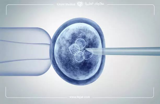 علاج العقم عند النساء بالخلايا الجذعية
