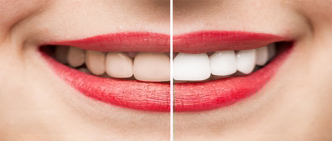 Orthodontic