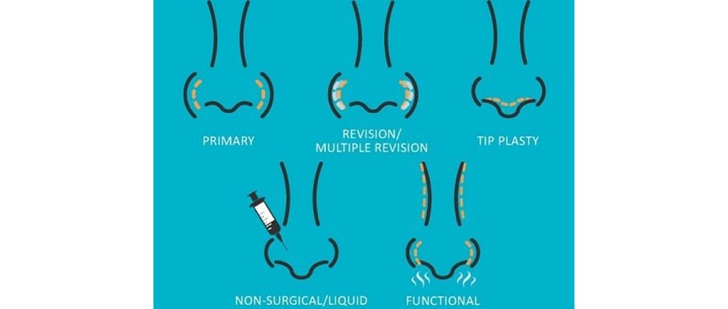 Rhinoplasty experiences in Turkey