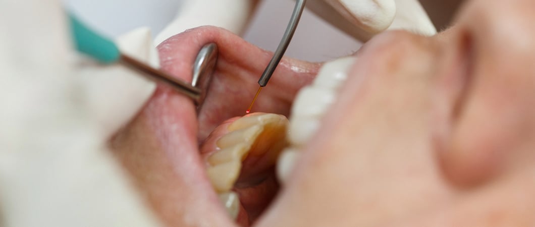 Rebuilding the gums naturally