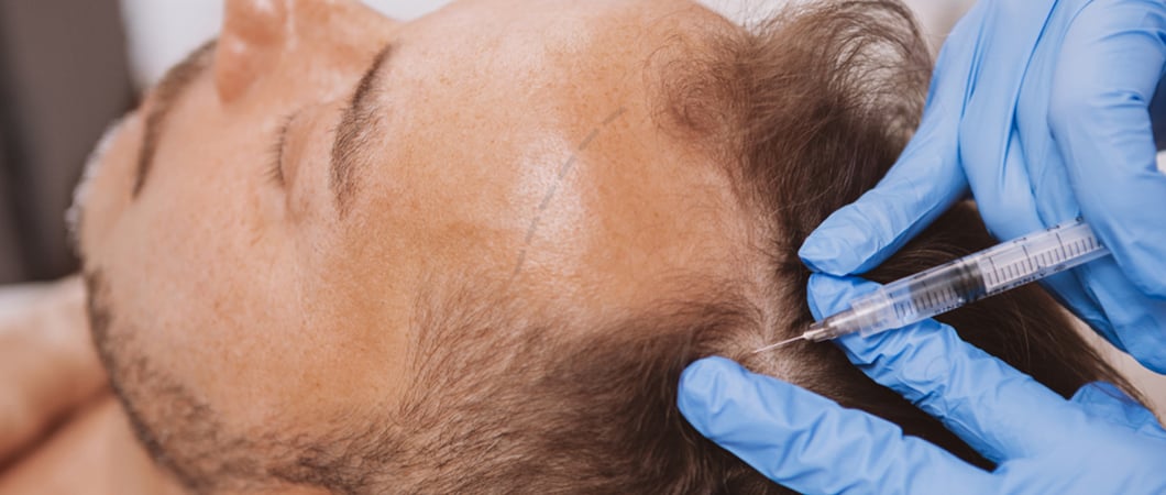 Hair Transplant without shaving possible in Turkey