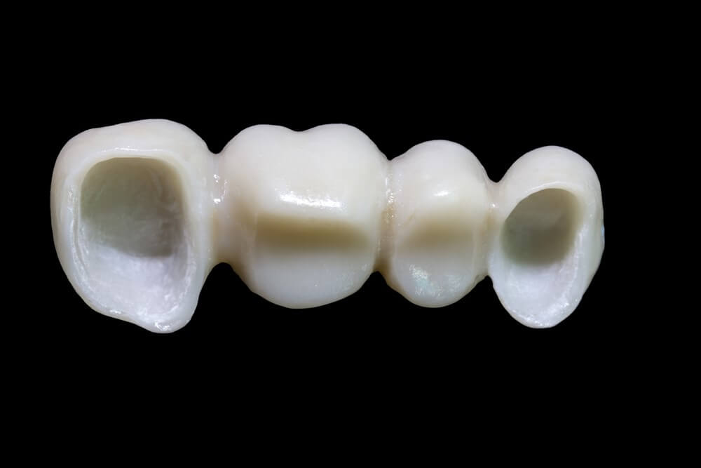 الفرق بين تركيب أسنان البورسلان والزيركون؟