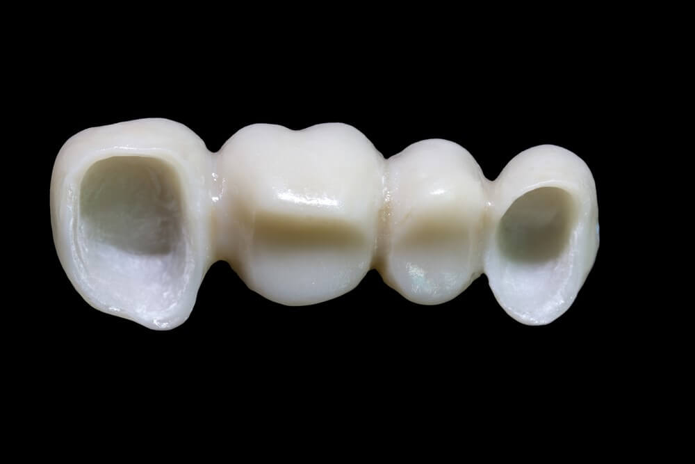 Porcelain crown vs zirconia crown